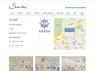 Smille - bělení zubů 